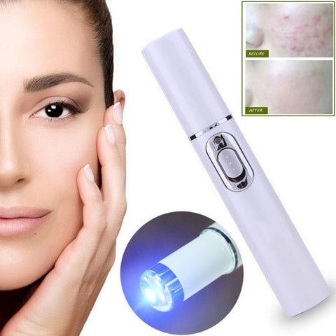 Laser Spot Remover Pen - Acne, Scars and Wrinkles Removal